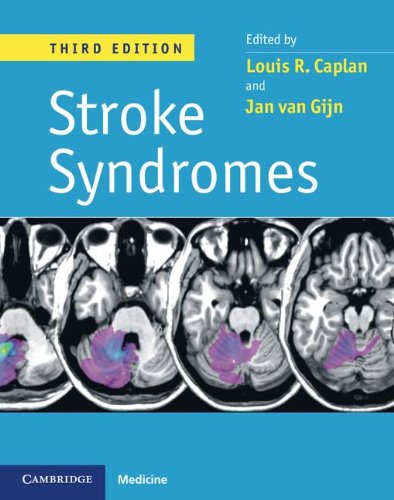 Stock image for Stroke Syndromes for sale by Better World Books