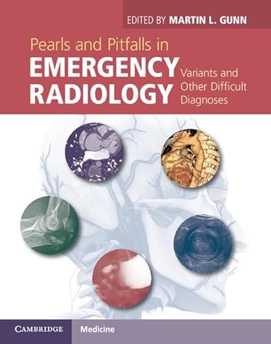 9781107021914: Pearls and Pitfalls in Emergency Radiology: Variants and Other Difficult Diagnoses