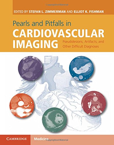 Stock image for Pearls and Pitfalls in Cardiovascular Imaging: Pseudolesions, Artifacts, and Other Difficult Diagnoses for sale by ThriftBooks-Atlanta