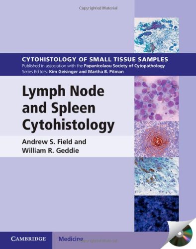 9781107026322: Lymph Node and Spleen Cytohistology