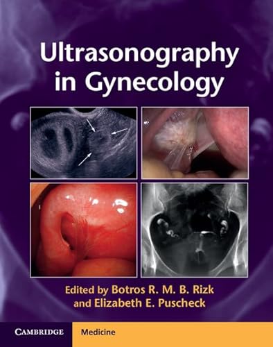 Stock image for Ultrasonography in Gynecology (Hardcover) for sale by Grand Eagle Retail