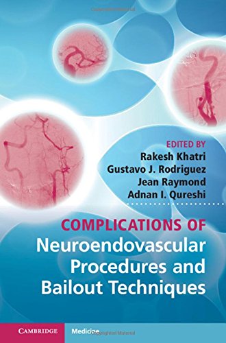 Stock image for Complications of Neuroendovascular Procedures and Bailout Techniques for sale by WorldofBooks