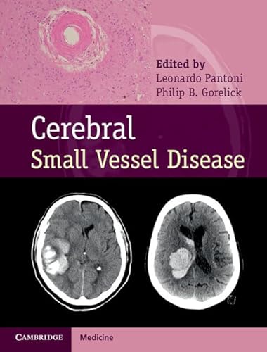 Beispielbild fr Cerebral Small Vessel Disease zum Verkauf von Blackwell's