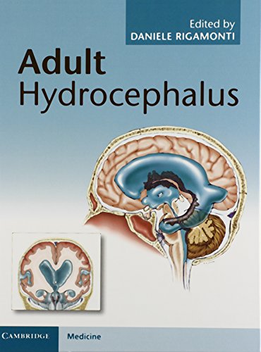 Stock image for Adult Hydrocephalus for sale by Blackwell's
