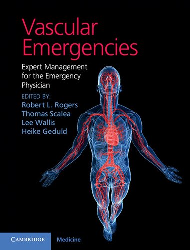 9781107035027: Vascular Emergencies: Expert Management for the Emergency Physician
