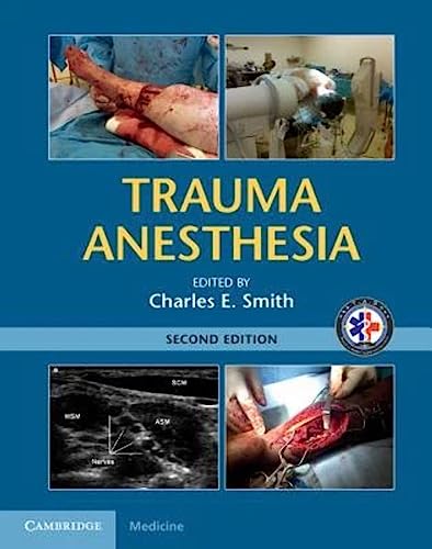 9781107038264: Trauma Anesthesia