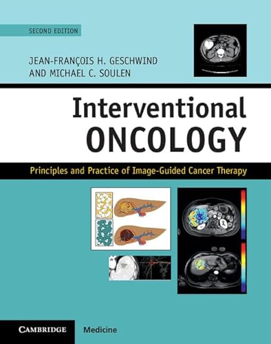 Stock image for Interventional Oncology Principles and Practice of ImageGuided Cancer Therapy for sale by PBShop.store US