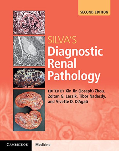 Immagine dell'editore per Silva*s Diagnostic Renal Pathology venduto da Mispah books