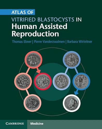 Stock image for Atlas of Vitrified Blastocysts in Human Assisted Reproduction for sale by Blackwell's