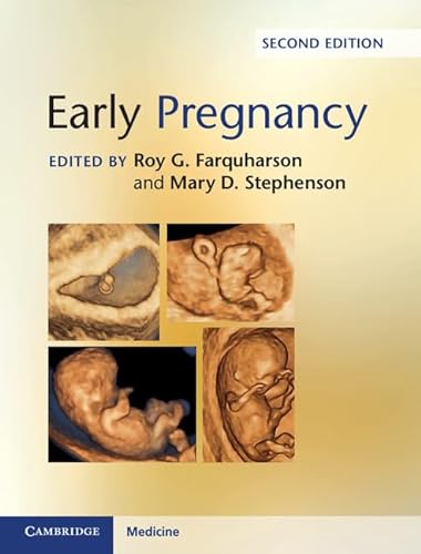 Stock image for Early Pregnancy for sale by WorldofBooks