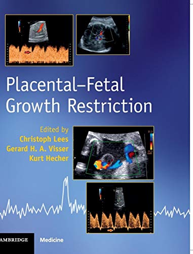 Beispielbild fr Placental-Fetal Growth Restriction zum Verkauf von Prior Books Ltd