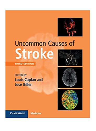 Imagen de archivo de Uncommon Causes of Stroke a la venta por Greener Books