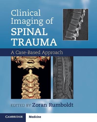 Beispielbild fr Clinical Imaging of Spinal Trauma: A Case-Based Approach zum Verkauf von AMM Books