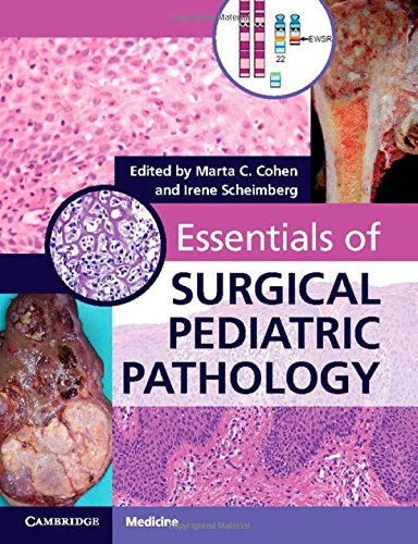 9781107430808: Essentials of Surgical Pediatric Pathology with DVD-ROM