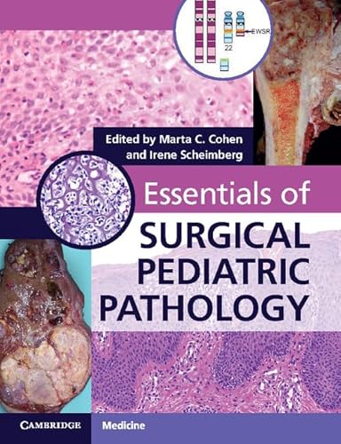 Stock image for Essentials of Surgical Pediatric Pathology with DVD-ROM for sale by GoldBooks