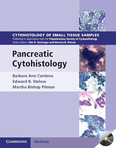 Imagen de archivo de Pancreatic Cytohistology (Cytohistology of Small Tissue Samples) a la venta por GoldenWavesOfBooks