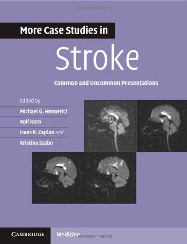 Imagen de archivo de More Case Studies in Stroke : Common and Uncommon Presentations a la venta por Better World Books