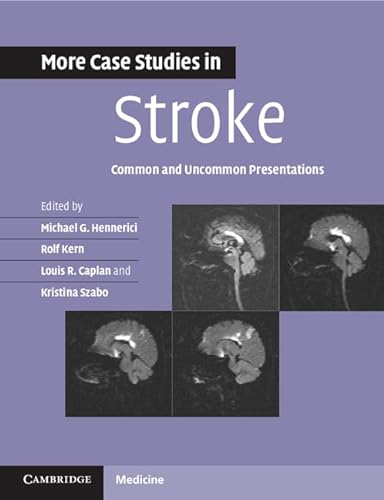 9781107610033: More Case Studies in Stroke: Common and Uncommon Presentations (Case Studies in Neurology)