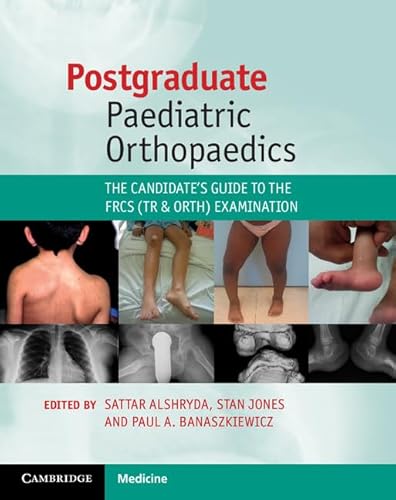 Stock image for Postgraduate Paediatric Orthopaedics: The Candidate's Guide to the FRCS (Tr and Orth) Examination for sale by Labyrinth Books