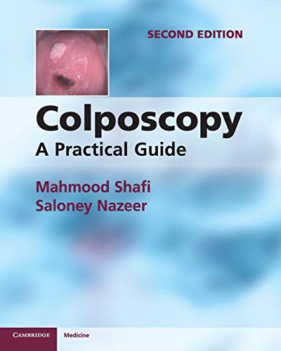 9781107667822: Colposcopy: A Practical Guide