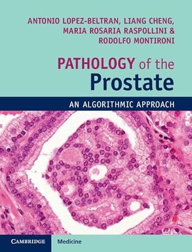 Beispielbild fr Pathology of the Prostate: An Algorithmic Approach zum Verkauf von AwesomeBooks