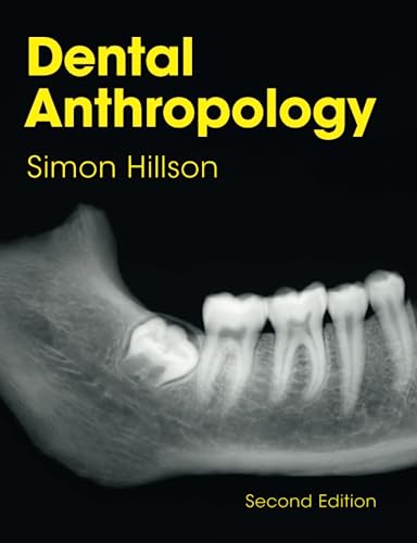 Stock image for Dental Anthropology for sale by Blackwell's