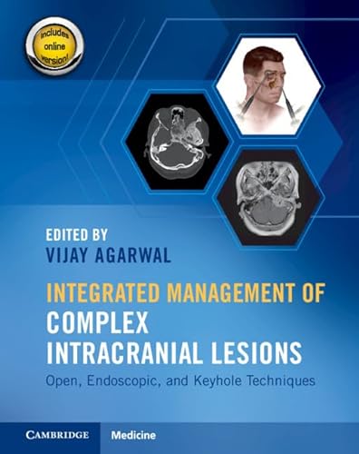 Stock image for Integrated Management of Complex Intracranial Lesions Hardback Set and Static Online Product for sale by PBShop.store US