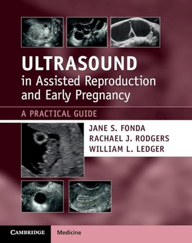 Imagen de archivo de Ultrasound in Assisted Reproduction and Early Pregnancy a la venta por Blackwell's