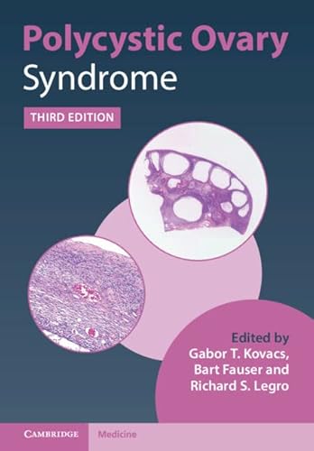 Beispielbild fr Polycystic Ovary Syndrome zum Verkauf von Blackwell's