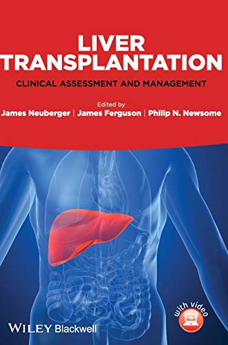 Stock image for Liver Transplantation for sale by Books Puddle