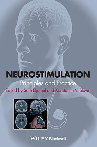 9781118346358: Neurostimulation: Principles and Practice
