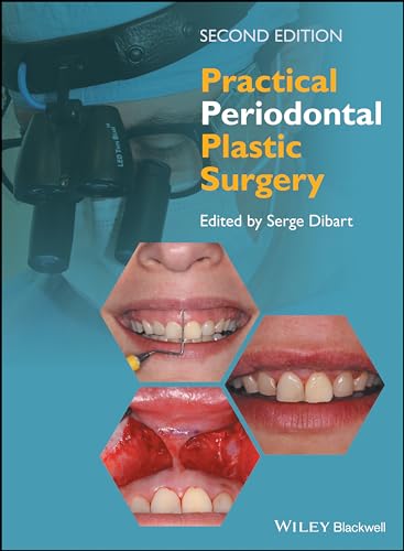 Imagen de archivo de Practical Periodontal Plastic Surgery a la venta por Chiron Media