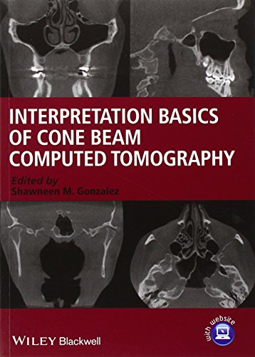 9781118381069: Interpretation Basics of Cone Beam Computed Tomography