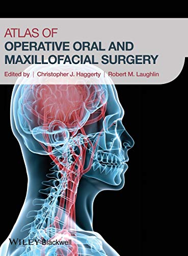 Stock image for Atlas of Operative Oral and Maxillofacial Surgery for sale by Better World Books: West