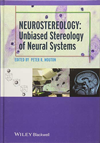 stereology basics stereology basics
