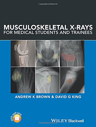 Beispielbild fr Musculoskeletal X-Rays for Medical Students and Trainees zum Verkauf von Blackwell's