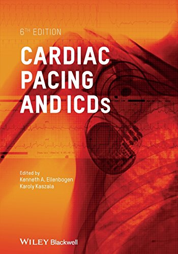 Stock image for Cardiac Pacing and ICDs for sale by HPB-Red