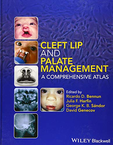 Beispielbild fr Cleft Lip and Palate Management zum Verkauf von Blackwell's