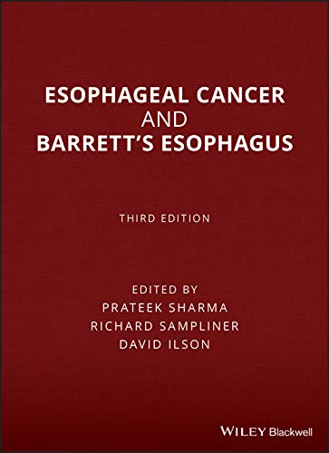 9781118655207: Esophageal Cancer and Barrett′s Esophagus 3e