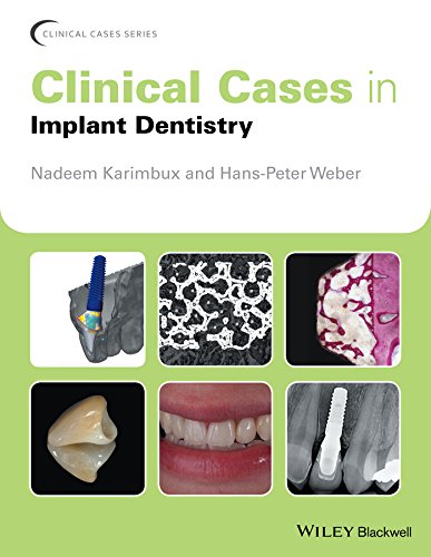 Beispielbild fr Clinical Cases in Implant Dentistry zum Verkauf von Blackwell's