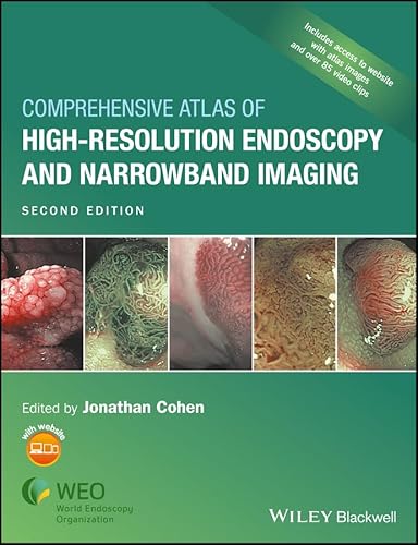 Stock image for Comprehensive Atlas of High Resolution Endoscopy and Narrowband Imaging for sale by Chiron Media