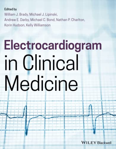 Beispielbild fr Electrocardiogram in Clinical Medicine zum Verkauf von AwesomeBooks
