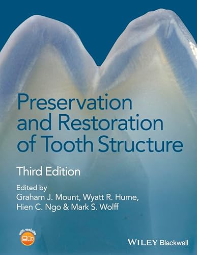 Stock image for Preservation and Restoration of Tooth Structure for sale by Blackwell's