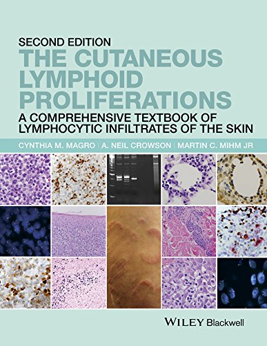 Beispielbild fr The Cutaneous Lymphoid Proliferations: A Comprehensive Textbook of Lymphocytic Infiltrates of the Skin zum Verkauf von Books Unplugged