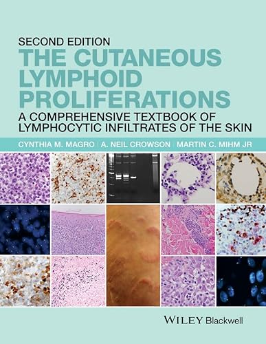 Stock image for The Cutaneous Lymphoid Proliferations: A Comprehensive Textbook of Lymphocytic Infiltrates of the Skin for sale by Books Unplugged