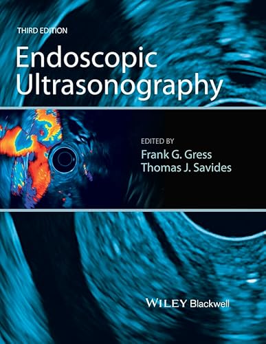 Stock image for Endoscopic Ultrasonography for sale by Books Puddle