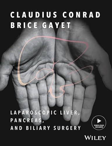 Stock image for Laparoscopic Liver, Pancreas, and Biliary Surgery, Textbook and Illustrated Video Atlas for sale by Save With Sam