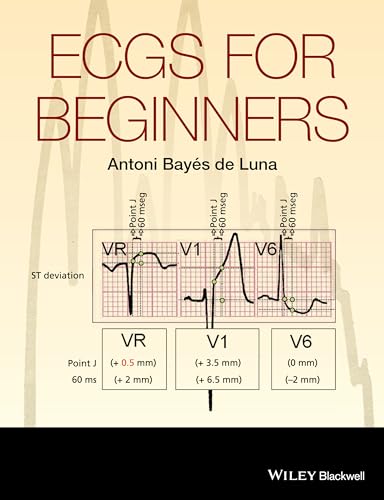 Stock image for ECGs for Beginners for sale by Blackwell's