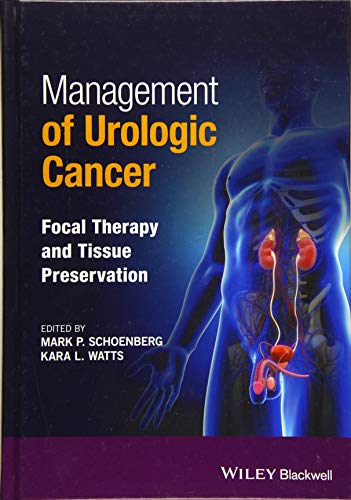 Stock image for Management Of Urologic Cancer Focal Therapy And Tissue Preservation (Hb 2017) for sale by Basi6 International