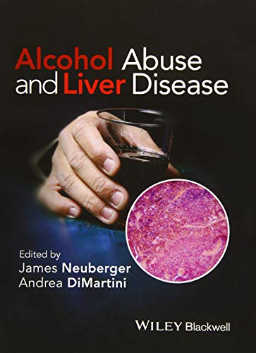 Stock image for Alcohol Abuse and Liver Disease for sale by Solr Books